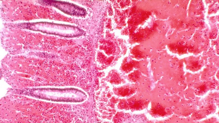 Aparato excretor: qué es, partes, funciones y enfermedades
