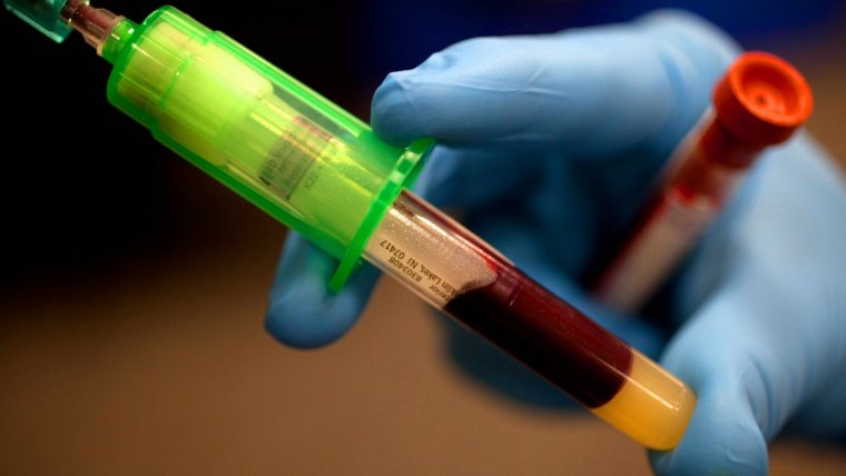 ¿Qué es CancerSeek?