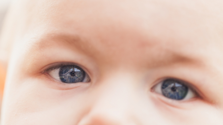 El nistagmo congénito o síndrome de nistagmo infantil (SNI) suele presentarse durante los primeros meses de vida del bebé.