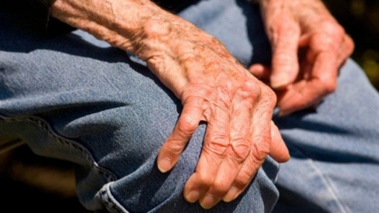 Paciente con esclerosis lateral amiotrófica (ELA). | Imagen de: CMM Salud.