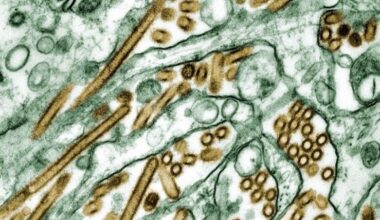 La gripe está causada por virus y provoca síntomas como la fiebre, más graves que en el resfriado.