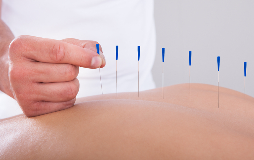 Qué es la acupuntura