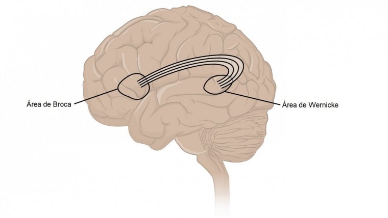 La causa principal de la afasia en un daño en áreas específicas del cerebro. 