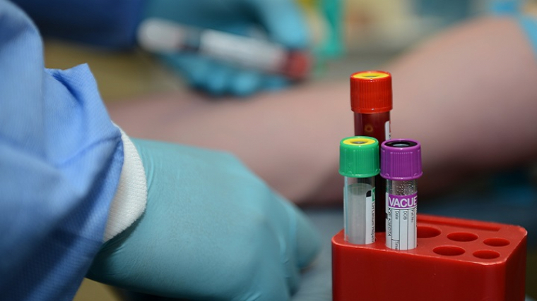 El grupo sanguíneo Rh nulo es donante universal de los tipos de sangre raros | .