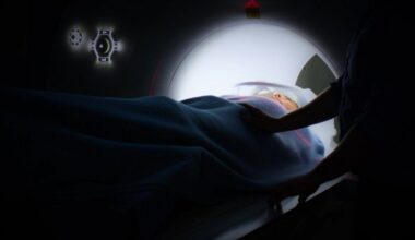 La resonancia magnética se hace con un aparato de forma cúbica alargada.