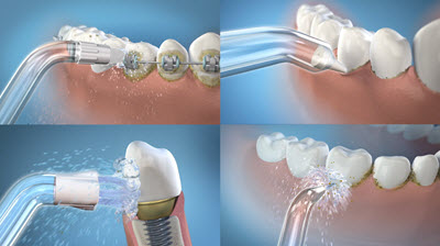 Waterpik, la manera fácil y eficaz de limpiar entre dientes | Cedida
