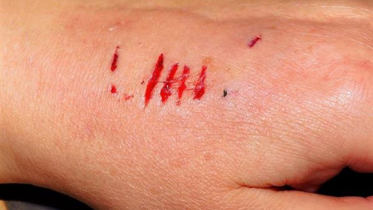 Es bueno cubrir la herida con algún tipo de gasa.